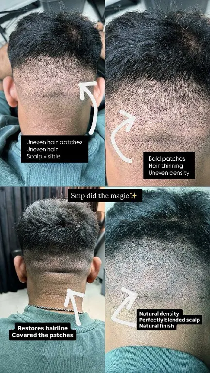 Syinger Tattoos scalp micropigmentation work